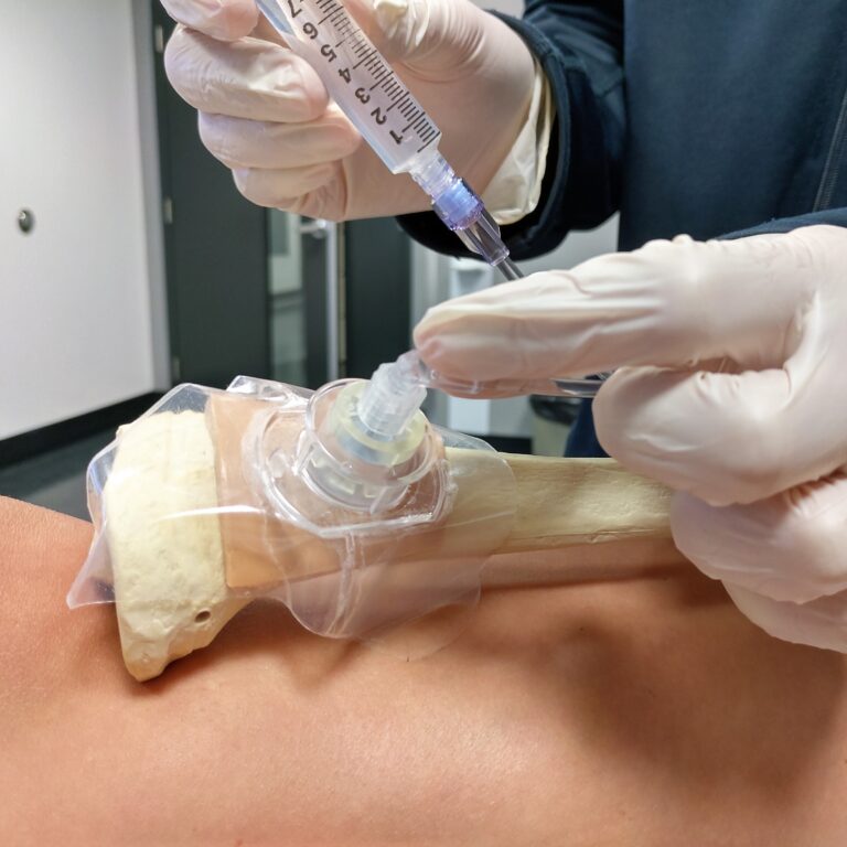 Utiliser La Moelle Osseuse Pour Faire Du Sperm