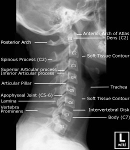 cervical-spine-lateral