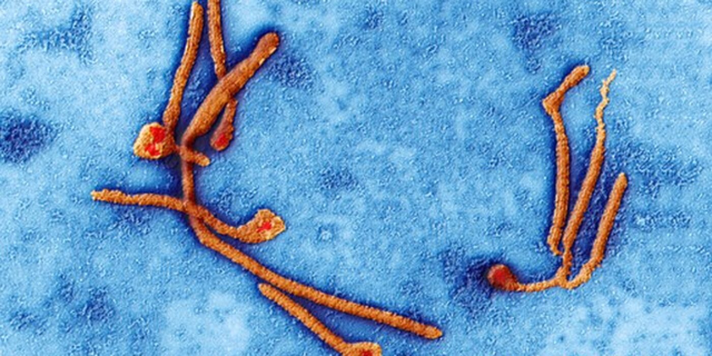 _76758680_c0213035-ebola_virus_particles,_tem-spl