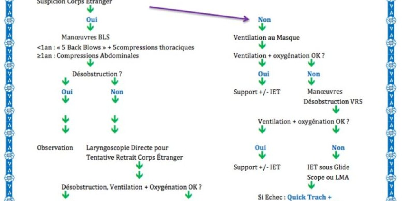 Algo défaillance respiratoire et obstruction