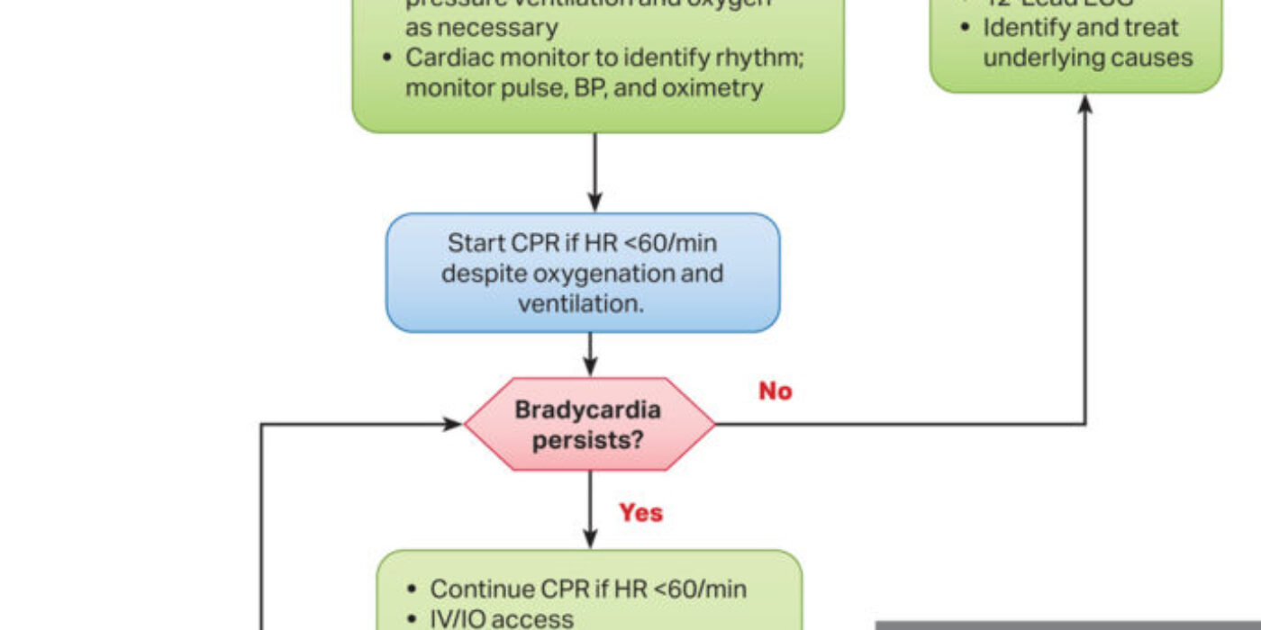 AlgorythmeBradyavecpouls