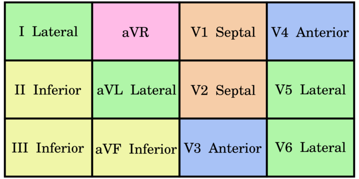 Contiguous_leads.svg