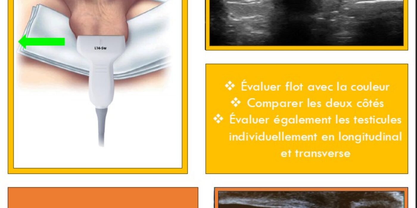 EDU 4 Torsion testiculaire