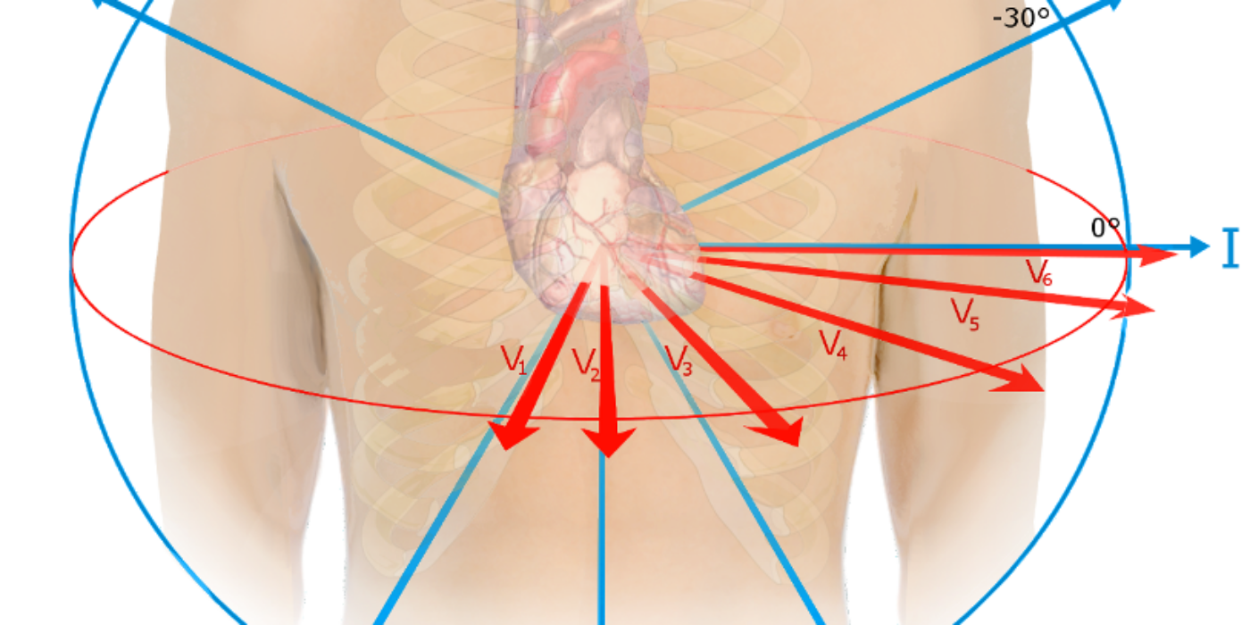 EKG_leads