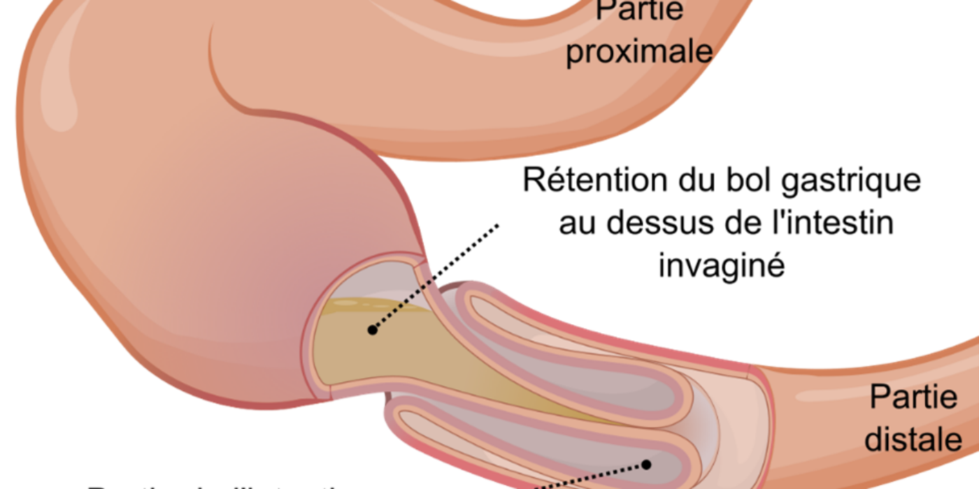 Invagination Orem Wikimedia