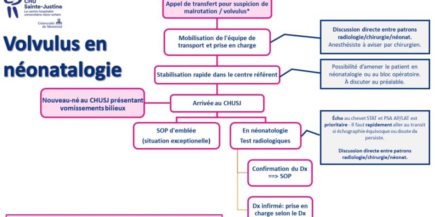 Prise en charge volvulus Néonatalogie 20221108