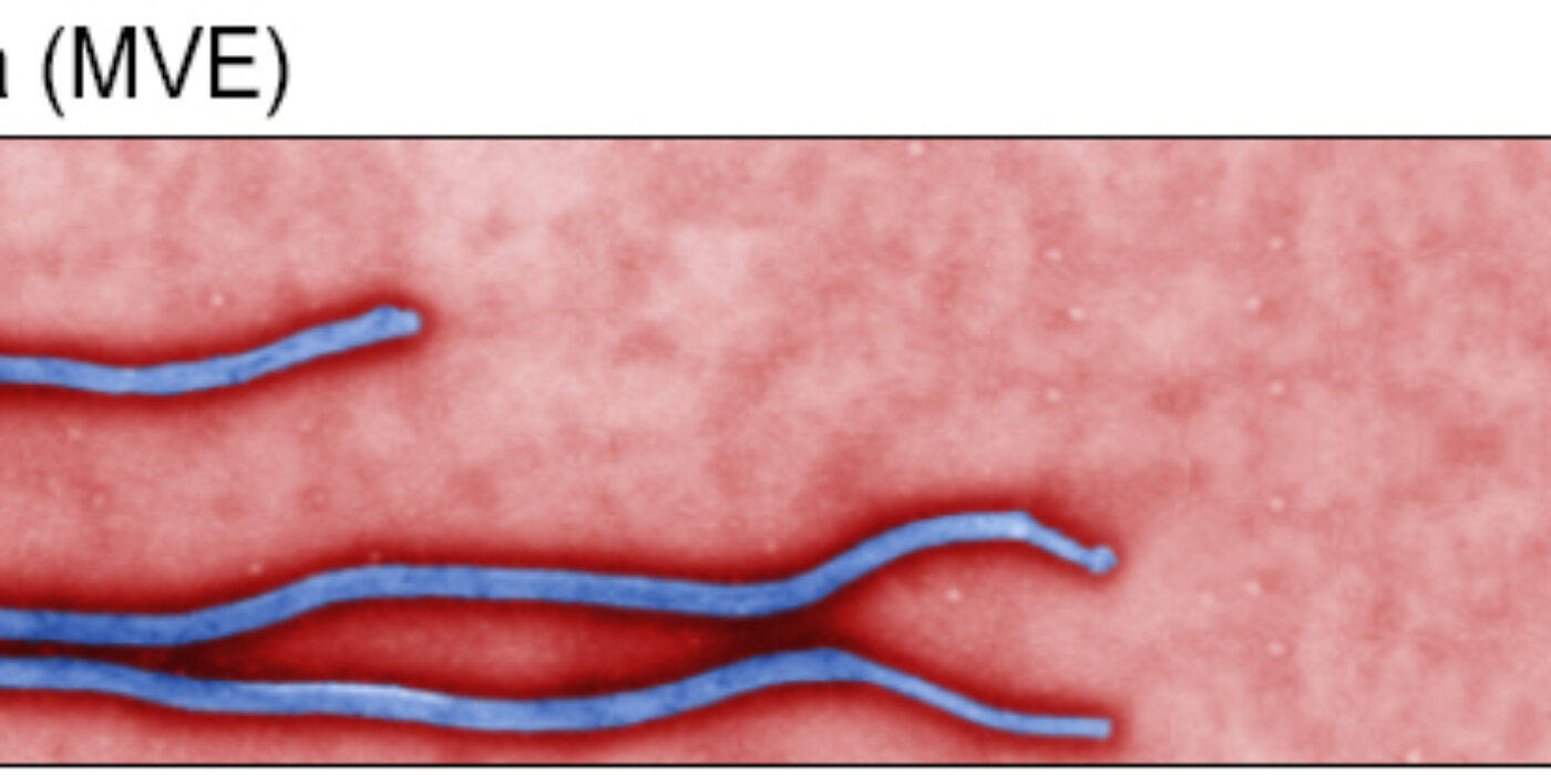 RTEmagicC_Entete_Ebola_05.jpg