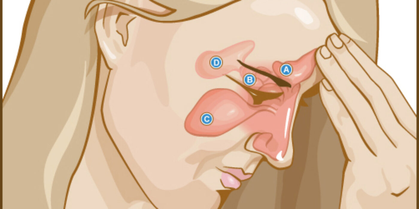 Sinuses_(5937618994)