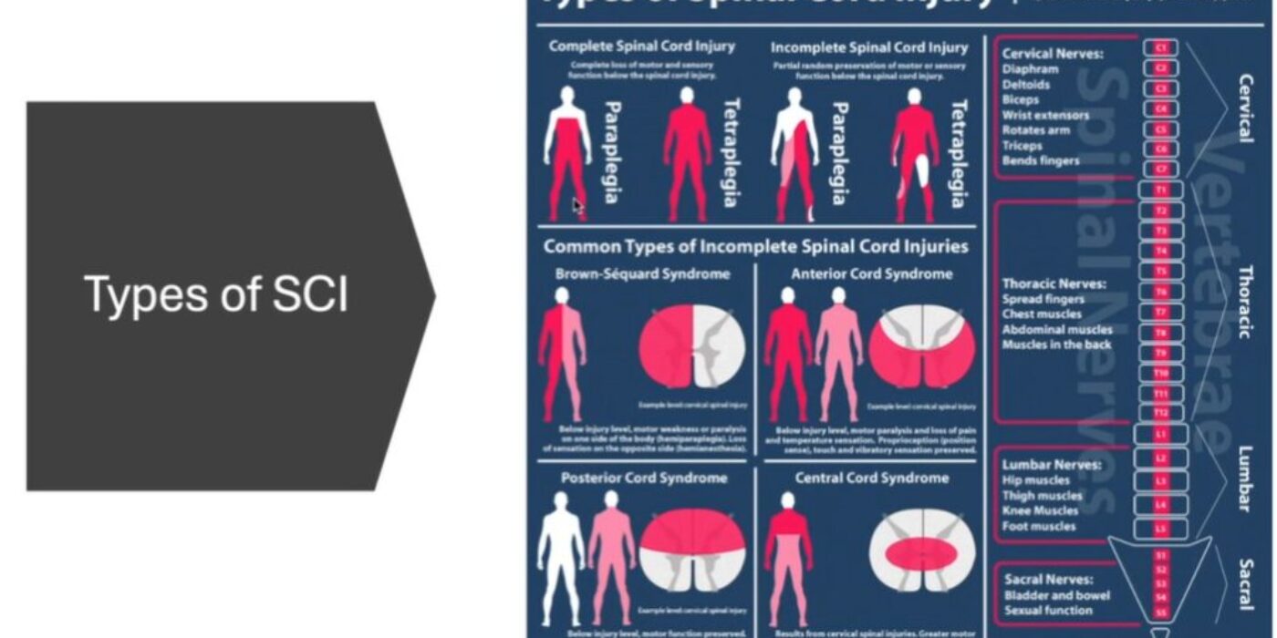 Spinal cord injuries 2