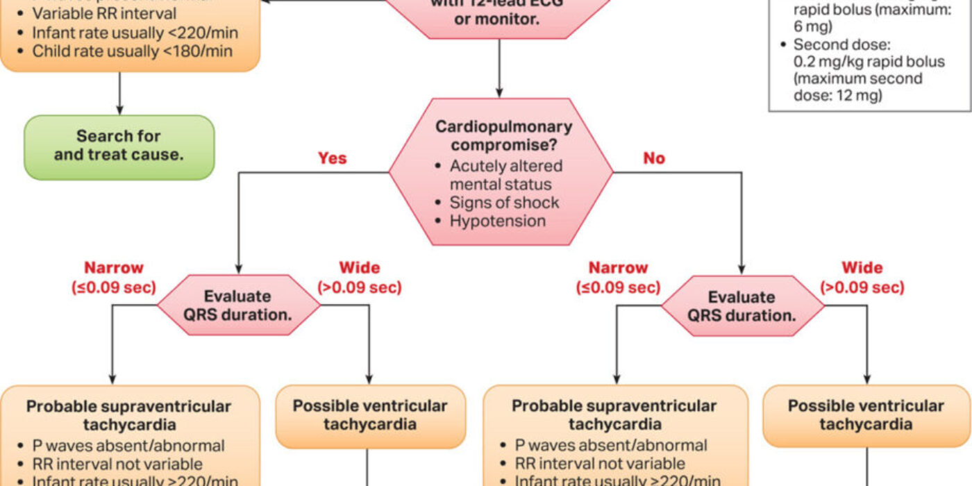 Tacycardieavecpouls