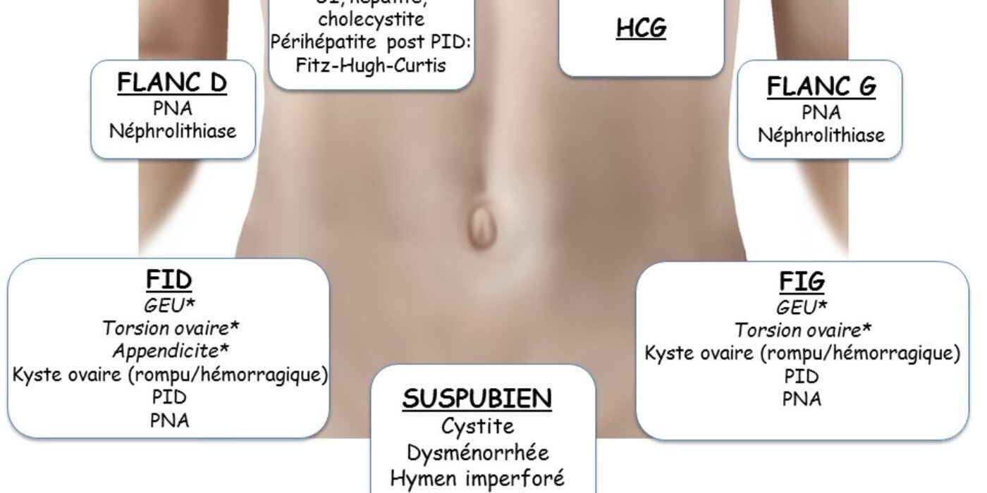 Urgence gyneco ddx