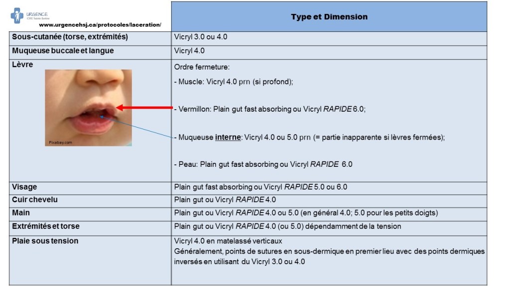 types sutures VRAI VRAI